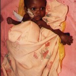 a-child-suffering-from-aids-there-are-many-such-victims-who-need-help-like-foodarvs-and-counselling1-150x150